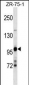 ULK2 Antibody (Center S323)
